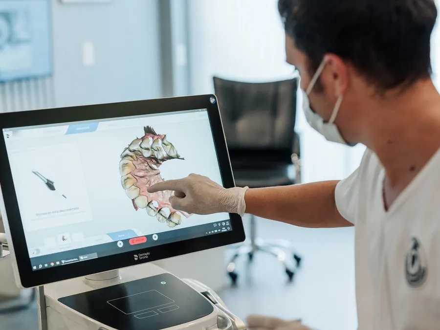Escaneo intraoral digital en COAM: el modelo 3D de la boca en la pantalla del escáner